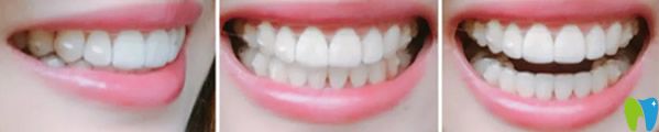 康祖銘正畸<span style=