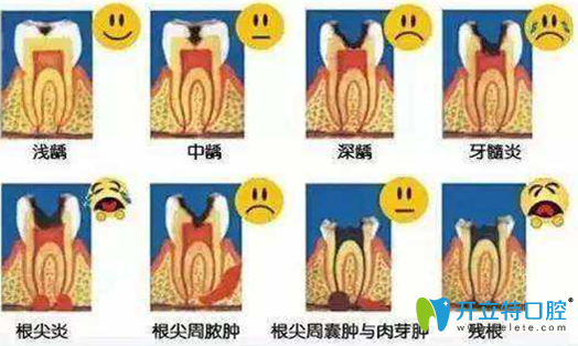 牙齒神經(jīng)痛發(fā)展過程圖