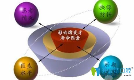 哪些因素影響烤瓷牙的壽命圖示