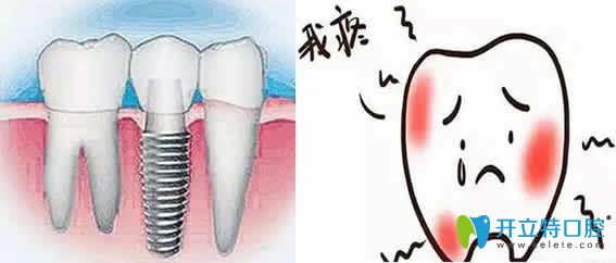 先了解種植牙后牙齦腫痛的原因，再看治療方法