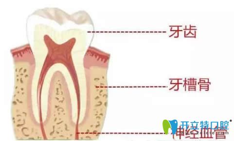 牙齒矯正會(huì)造成牙神經(jīng)壞死嗎?看牙齒矯正對(duì)牙神經(jīng)有傷害嗎