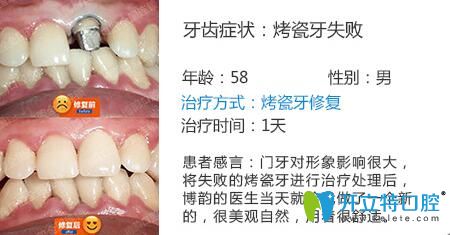 醫(yī)生姓名：周光正   醫(yī)生資質(zhì)：全科醫(yī)生  所屬機構(gòu)：南京博韻口腔  社會任職：  畢業(yè)院校：畢業(yè)于邢臺<!--<i data=20240703-sp></i>-->口腔醫(yī)學(xué)系  主診項目：牙列缺損修復(fù)、口腔種植、前牙美學(xué)修復(fù)、嵌體修復(fù)及復(fù)雜牙拔除。