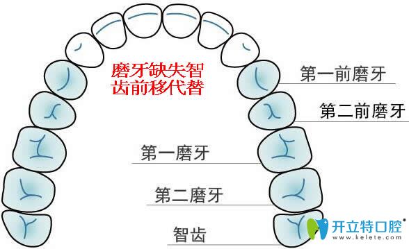 牙醫(yī)說出了智齒矯正后代替磨牙有沒有危害