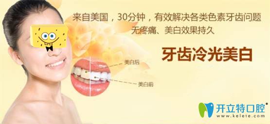 牙齒冷光美白效果圖