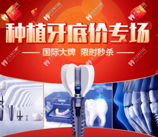 西安諾貝爾半口種植牙直降6萬,一顆2999元,收費(fèi)價(jià)格表這么低?