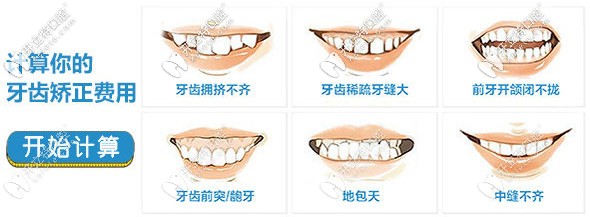 計(jì)算牙齒矯正的費(fèi)用