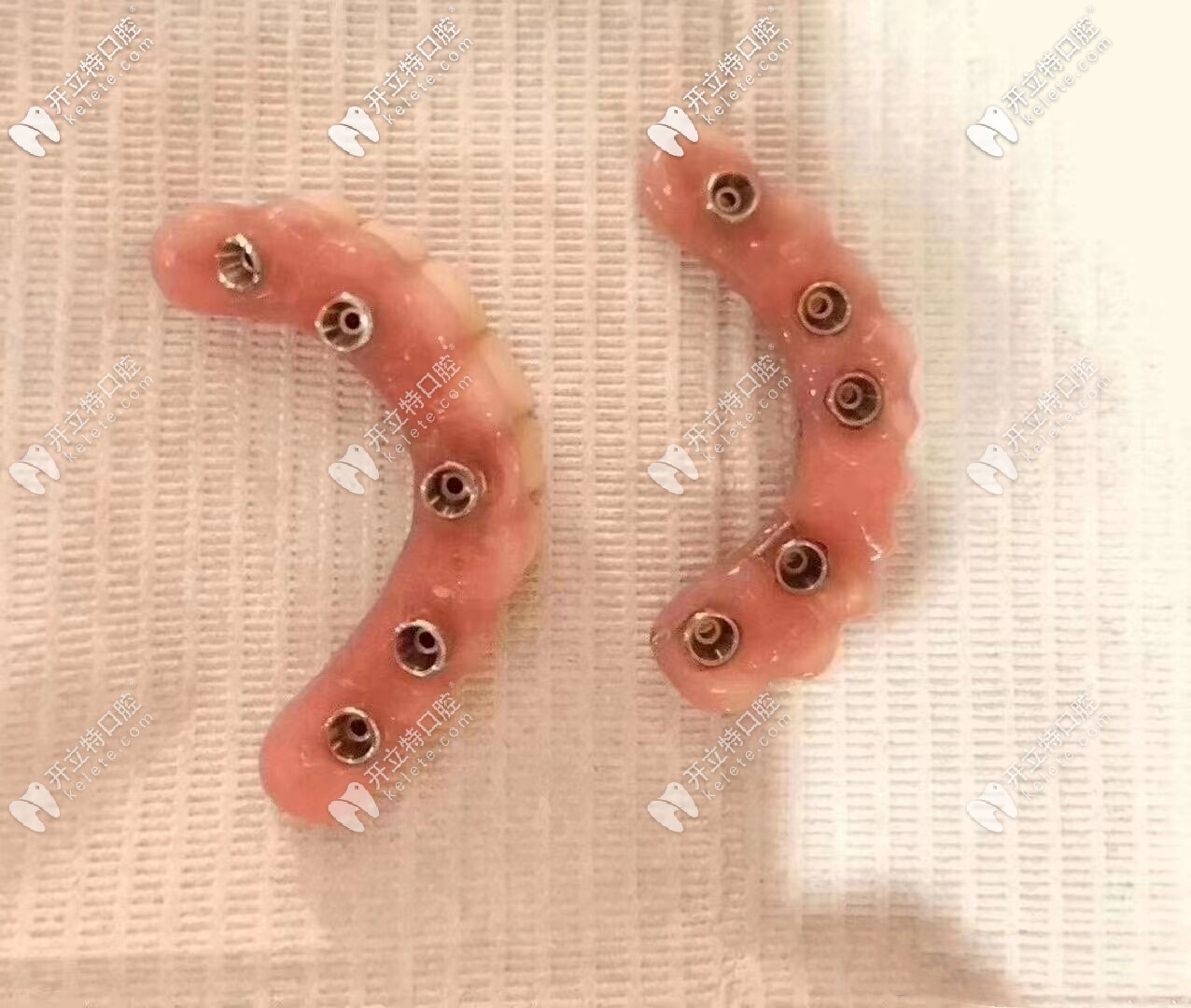 假牙圖片