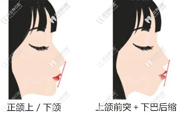 廣大正頜醫(yī)生何錦泉的手術(shù)理念