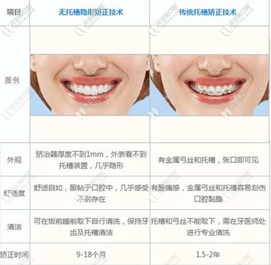 隱形矯正和金屬矯正的區(qū)別