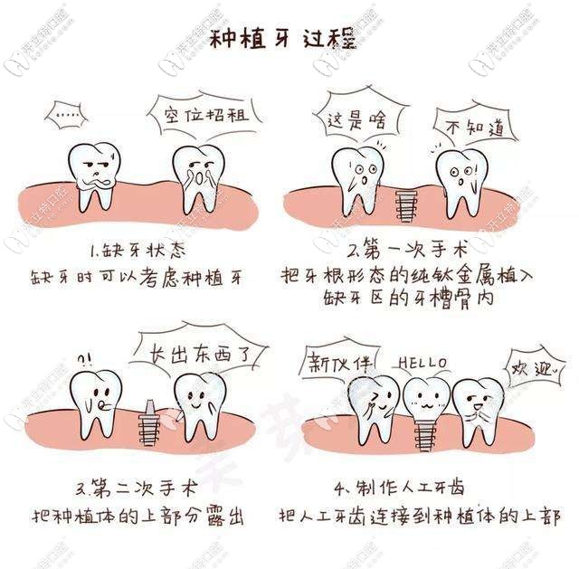 種植牙的過程