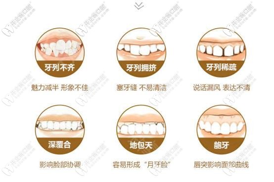 鋼牙套矯正器適應癥