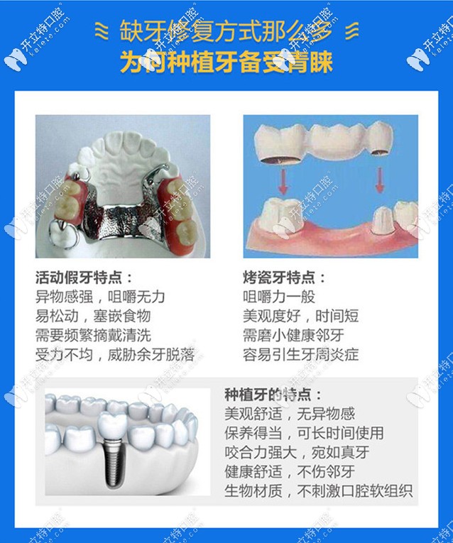 誰有成都圣貝牙科醫(yī)院種植牙價格表?聽說費用不是很高哦!