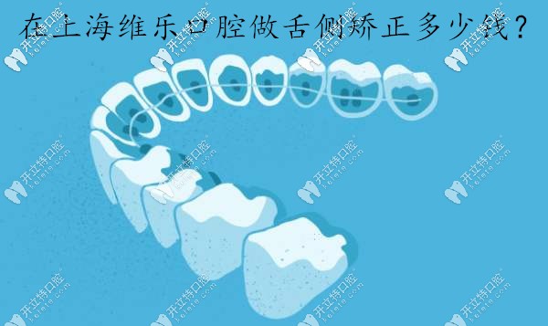 在上海維樂口腔做舌側(cè)全隱形矯正一般需要多少錢