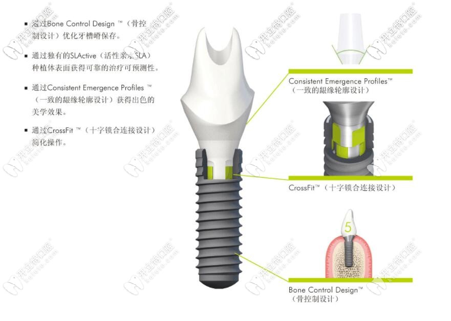 瑞士iti種植體型號中的nc和rc區(qū)別是?都是士卓曼骨水平植體嗎