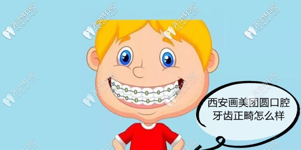 西安團圓口腔矯正牙齒怎么樣?團圓口腔正畸技術(shù)好價格不貴