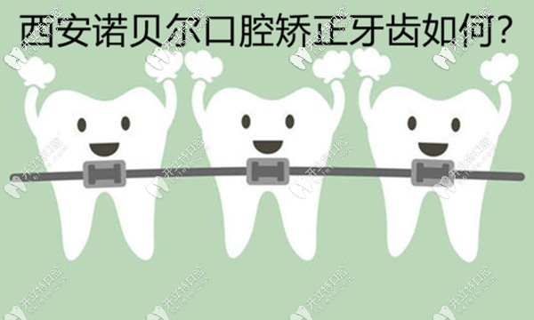 西安諾貝爾口腔矯正牙齒好不好，用正畸病例來評(píng)價(jià)下
